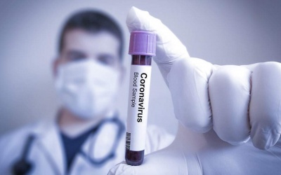 Τον Οκτώβριο του 2020 τα αποτελέσματα για το εμβόλιο του κορωνοϊού από το  Ινστιτούτο Παστέρ
